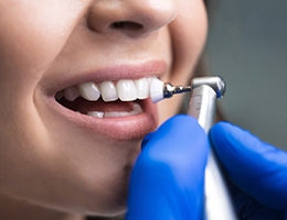 Teeth Cleaning (Existing patients) Teeth Cleaning (Existing patients)